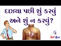 દાઝ્યા પછી શું કરવું અને શું ન કરવું ?