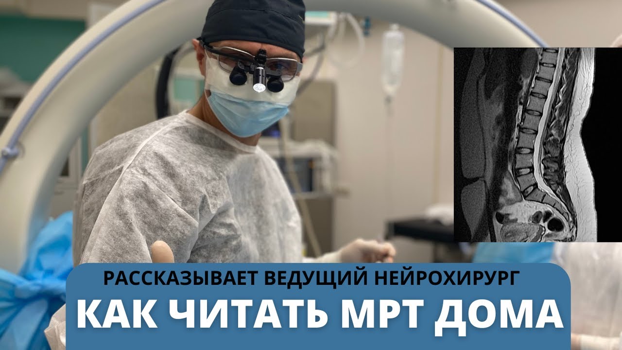 КАК ЧИТАТЬ МРТ ПОЯСНИЧНОГО ОТДЕЛА ПОЗВОНОЧНИКА САМОСТОЯТЕЛЬНО. Рассказывает ведущий нейрохирург.