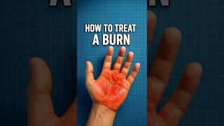 Why Toothpaste Makes Burns Worse