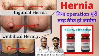 Homeopathic medicine for hernia- hernia cure without surgery / hernia ka jad se ilaj