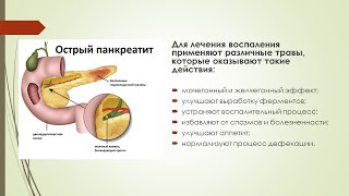 Лечение острого панкреатита в домашних условиях