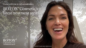 Before and After: BOTOX® Cosmetic for vertical bands connecting the neck and jaw