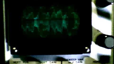 ham radio with oscilloscope connected