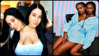 1 in A Million Conjoined Twins You Won’t Believe Exist🔥