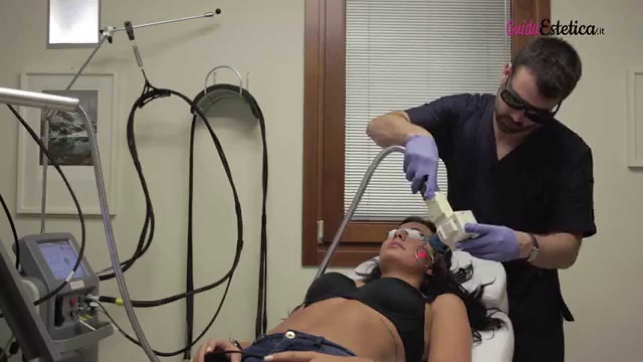L'epilazione con Laser ad Alessandrite o Neomidio Yag