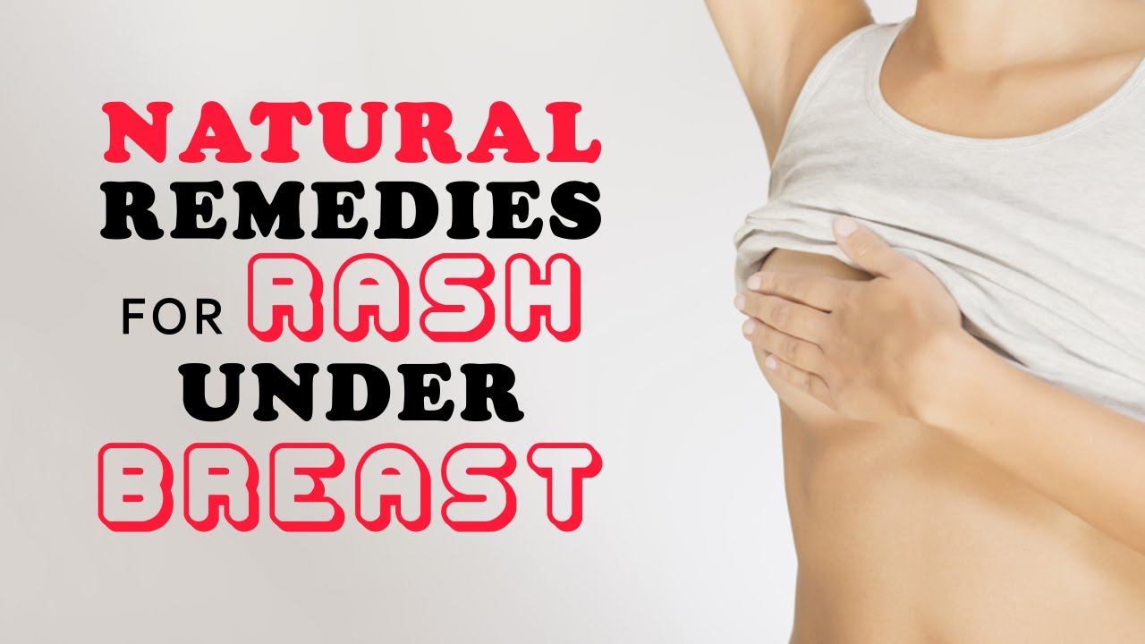 10 Natural Remedies for Rash Under Breast 