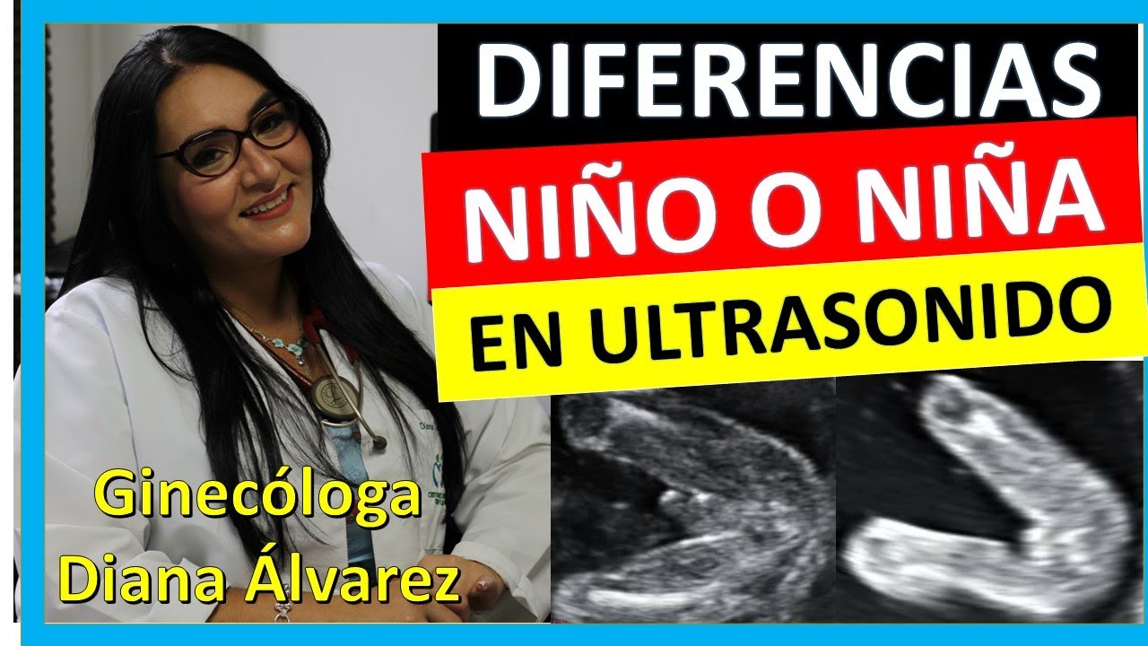 Como Saber Si Es Niño O Niña En Ultrasonido