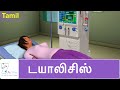 Understanding Dialysis and Related Concepts