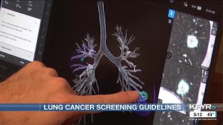 American Cancer Society updates its lung cancer screening guidelines