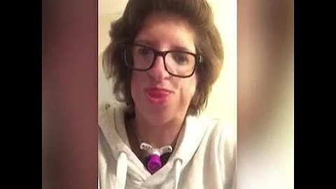 Woman with facial birth defect shows us how beauti...