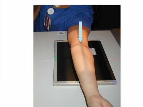 Ce4rt Radiographic Positioning Of The Elbow For X Ray Technicians