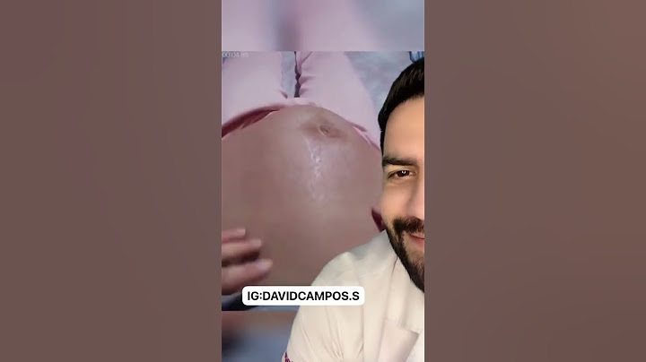 THIS IS HOW THE BABY MOVES INSIDE THE WOMB