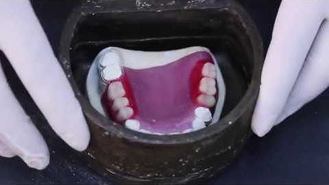 Lab # 6: Acrylic RPD Processing