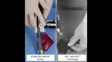 ECHELON LINEAR Cutter Gel Demo vs GIA Stapler with DST | J&J MedTech