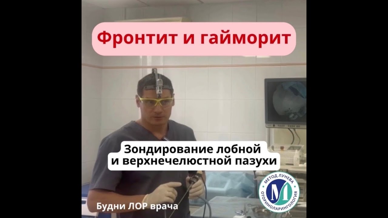 Фронтит и гайморит гнойный. Зондирование лобной и верхнечелюстной пазух ...