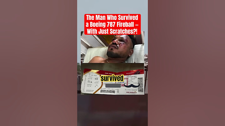 The Man Who Survived a Boeing 787 Fireball — With Just Scratches?!