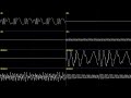 ○♪ The King of Fighters ‘97 - Psycho Soldier Remix '97 [Oscilloscope View]