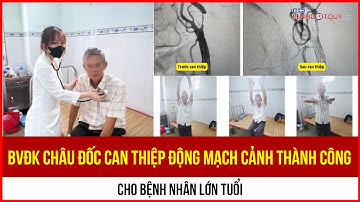 Bệnh viện Đa khoa Châu Đốc can thiệp động mạch cảnh thành công cho bệnh nhân lớn tuổi