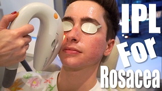 Rosacea Treatment with IPL Laser ft. Eric Smith