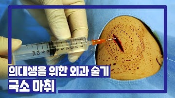 [서울성모병원] 외과 술기 5. 국소 마취