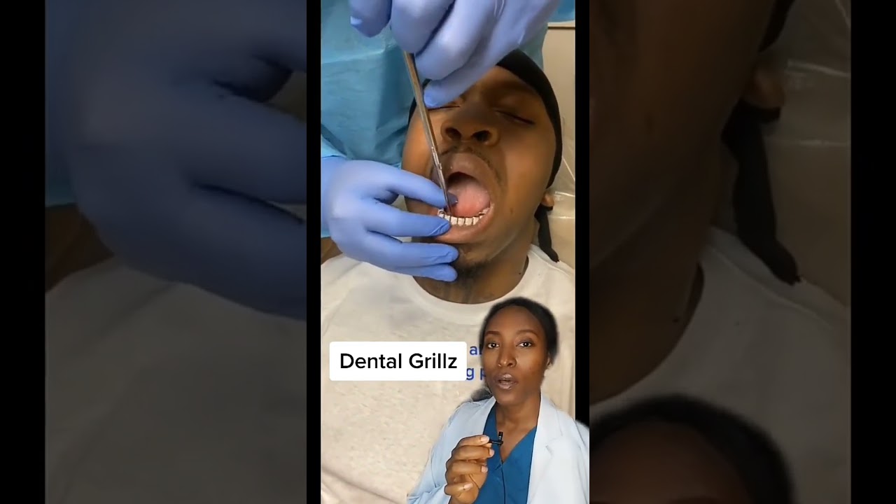 Removing teeth grillz 