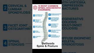 Top 10 Degenerative Spinal Disorders #bethesdaspineandposture #bethesdamd #posturecorrection #spine