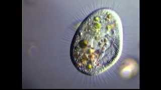 HISTIOBALANTIUM CILIADO CILIATE