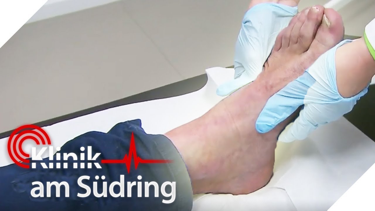 Fersenbeinbruch Wie Lange Dauert Die Heilung Fußbruch mit großem Geheimnis | Klinik am Südring | SAT.1 - YouTube