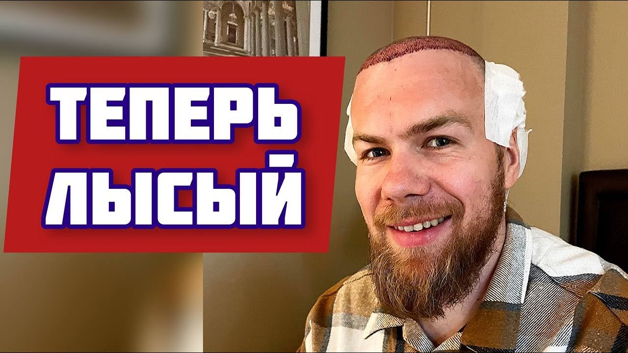 Операция по пересадке волос прошла успешно! Скоро ДОМОЙ) - YouTube