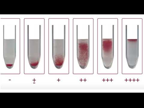 Определение группы крови AB0, антигенов системы Rh и Kell гелевым методом (тест-системы Biorad)