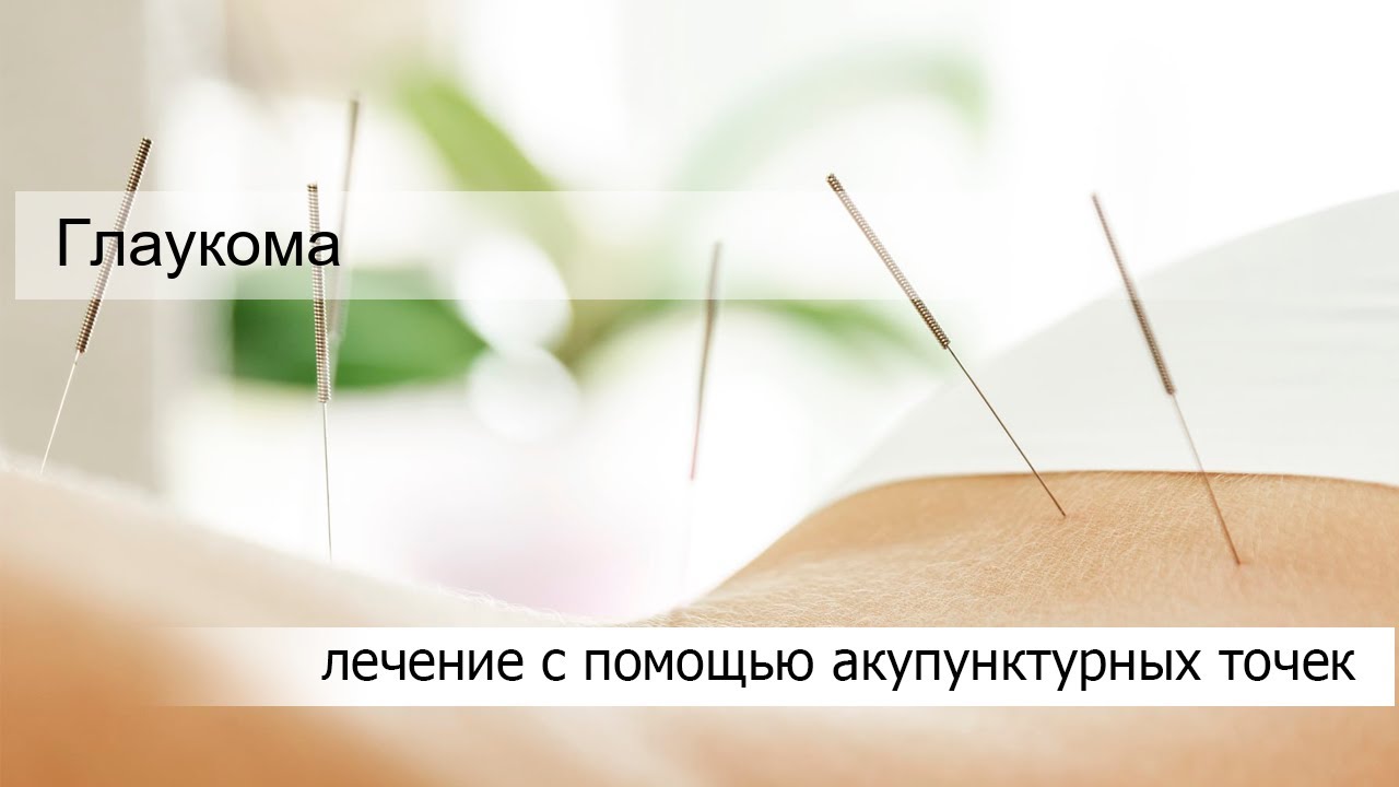 Глаукома - YouTube