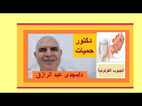 الجيوب القولونية وخطورتها وعلاجها  DIVERTICULOSIS