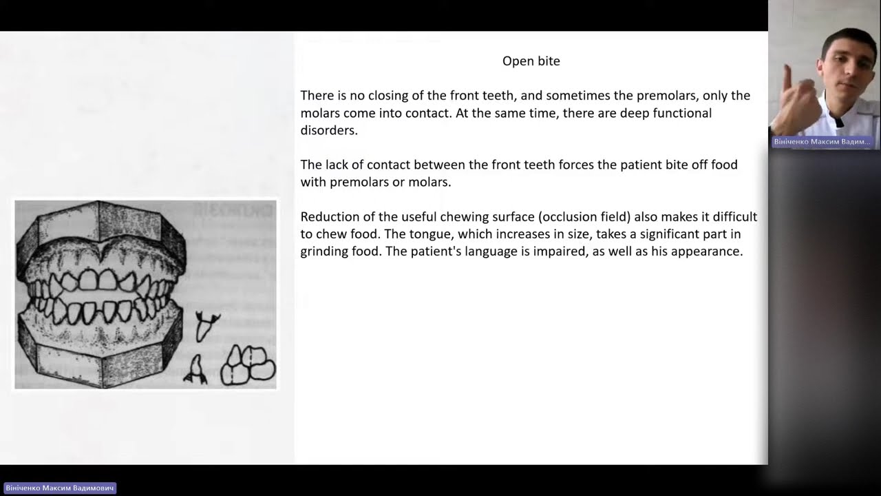II.2 - The sequence of examination of patients in prosthetic dentistry. Examination methods