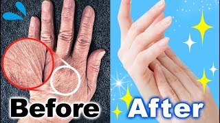手のしわを無くす方法！もう年齢を感じさせない