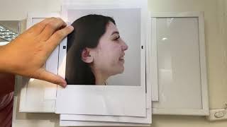 análisis cefalométrico