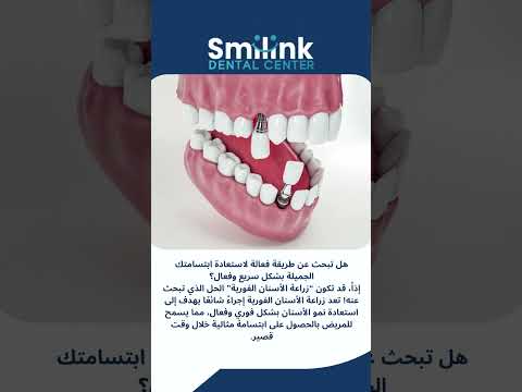 زراعة الاسنان فورية