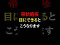 【危険】知らないと後悔する..急増している帯状疱疹の「目」のサイン#医師#帯状疱疹#予防医学チャンネル