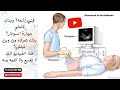 طريقه دراسة السونار بأسهل طريقة How To Study Ultrasound In The Easiest Way