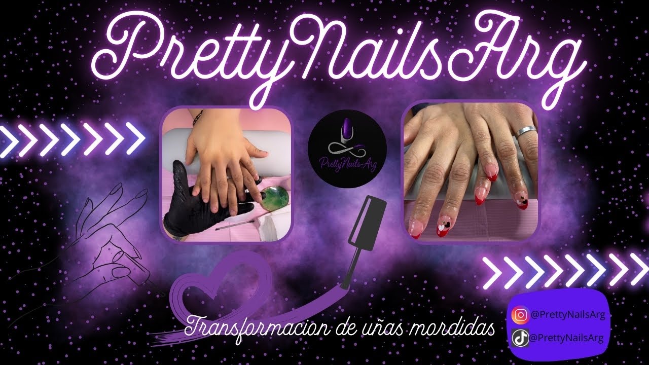 Transformación de Uñas Mordidas a Almendras Cortas con French Rojo (Paso a Paso)