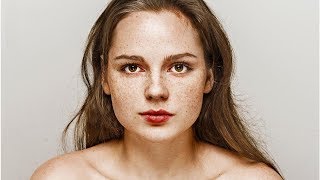 How to Grow Freckles Naturally and Safely