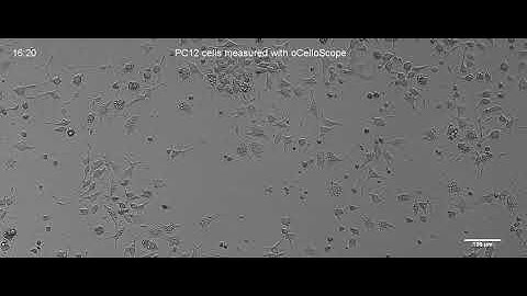 oCelloScope Live Cell imaging - PC12 cells