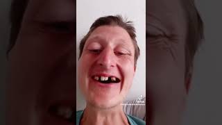 Famous Daniel larson shows his teath on camera Profile