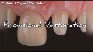 【DENTAL】Provisional Restoration with Stain. プロビジョナルレストレーションを内部ステインとコンポジットレジンを用いて作製 screenshot 3