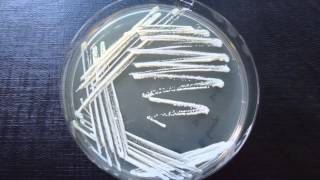 Streak plate method amrita university1