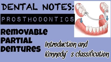 STUDY WITH ME I DENTAL NOTES I REMOVABLE PARTIAL DENTURE I KENNEDY