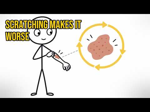 Why Scratching an Itch Feels So Good—and Makes It Worse