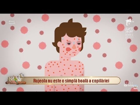 Video: Rujeola, Varicela, Rubeola și Alte Boli Infecțioase La Un Copil