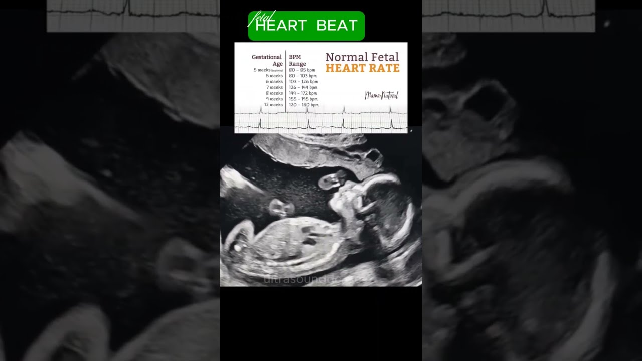Fetal Heart Rate Ultrasound Baby Reels Shorts