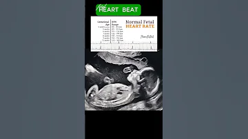 Fetal Heart Rate Ultrasound Baby Reels Shorts 