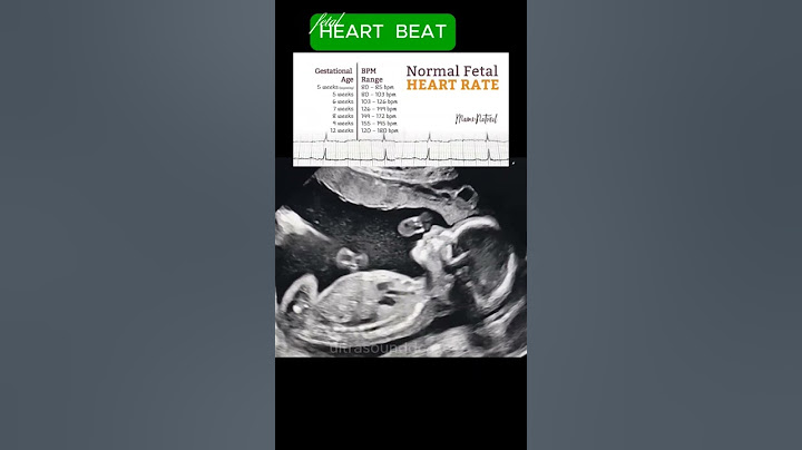 Fetal Heart Rate | Ultrasound #baby #reels #shorts